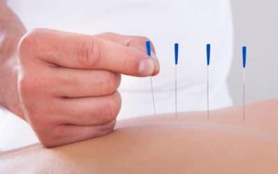 New Patient Acupuncture Treatment for $60