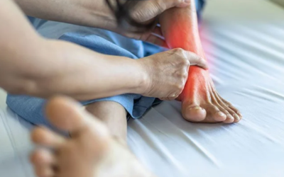 Stress Fractures: The Temporary Game Over for Physical Activities